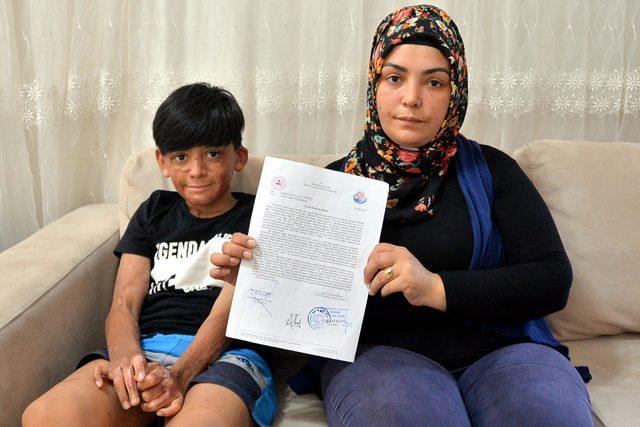 Yangında y&uuml;z&uuml; ve v&uuml;cudu yanan Umut i&ccedil;in kampanya 1