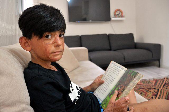 Yangında y&uuml;z&uuml; ve v&uuml;cudu yanan Umut i&ccedil;in kampanya 3