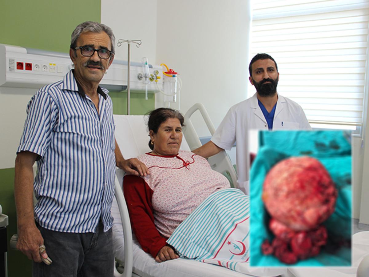 Manisa'da 4 yıldır karın ağrıları &ccedil;eken kadının karnından 7 kiloluk kitle &ccedil;ıktı