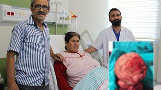 Manisa'da 4 yıldır karın ağrıları çeken kadının karnından 7 kiloluk kitle çıktı