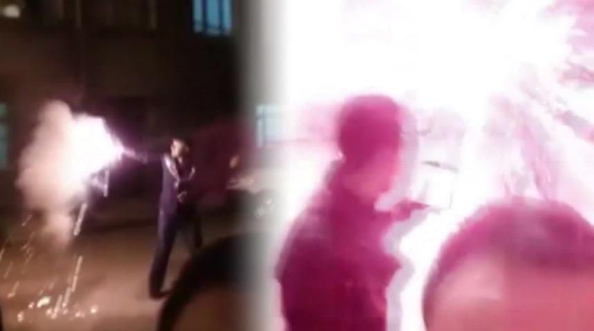 İstanbul'da asker eğlencesinde elinde yanıklar oluşan genç hastaneye kaldırıldı