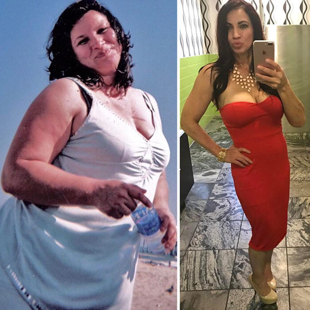 Она сильно похудела. Похудение до и после. Невероятные истории похудения. Преображение до и после похудения. Преображение людей до и после похудения.