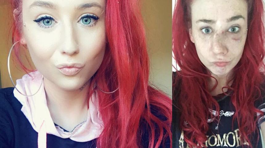 Model adayı genç kızın burnunu kırdılar