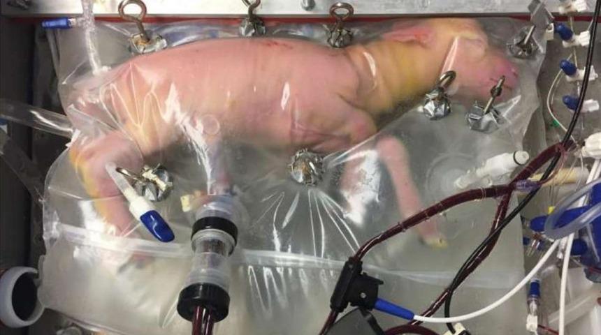 Yapay Rahim Erken Doğan Bebeklere Umut Olacak!