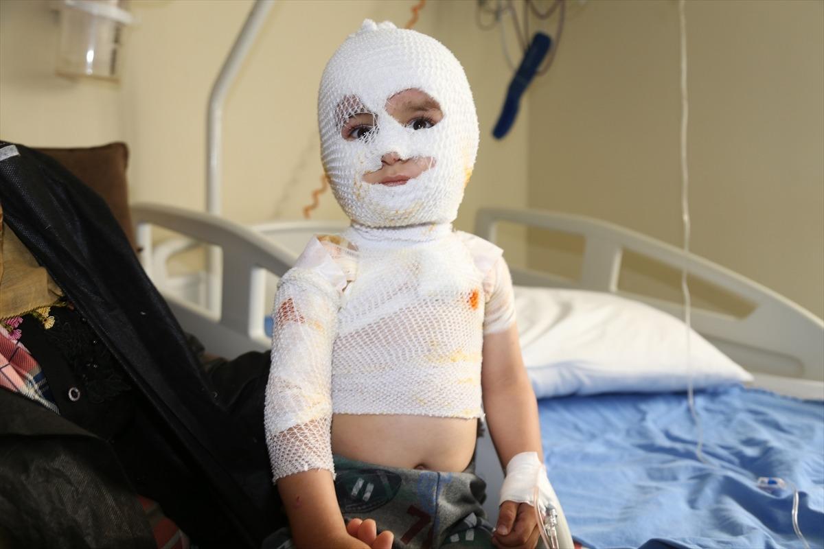 Y&uuml;rek yakan olay... Minik Yunus Emre iyileşmeyi bekliyor