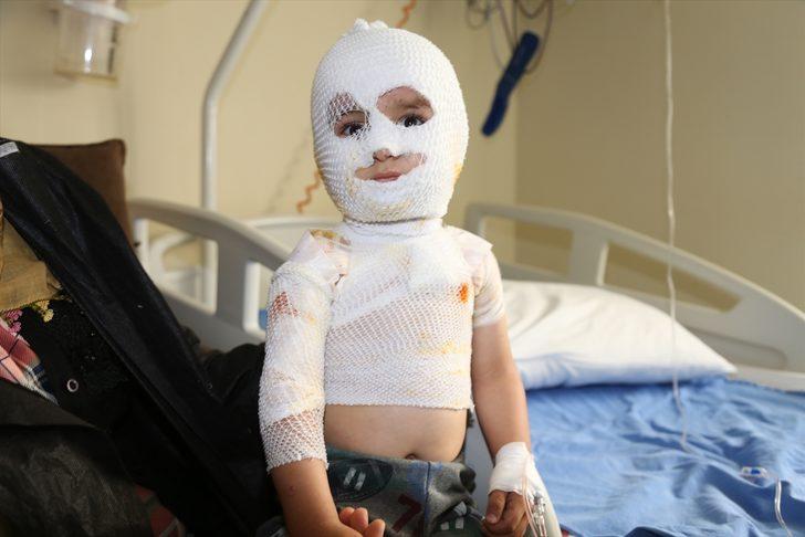 Yürek yakan olay... Minik Yunus Emre iyileşmeyi bekliyor G4