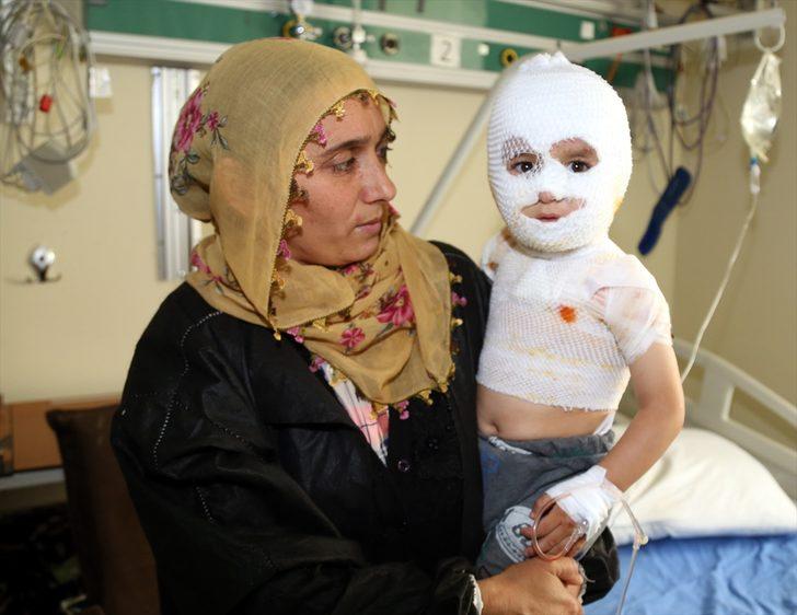 Yürek yakan olay... Minik Yunus Emre iyileşmeyi bekliyor G1