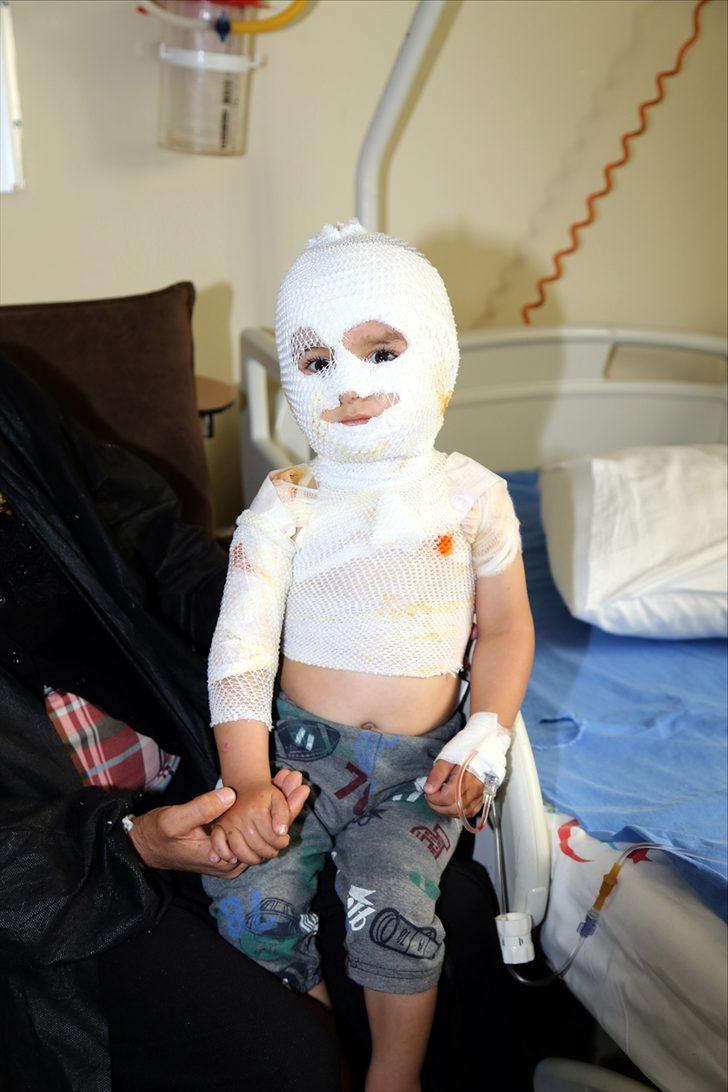 Yürek yakan olay... Minik Yunus Emre iyileşmeyi bekliyor G2