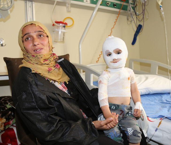 Yürek yakan olay... Minik Yunus Emre iyileşmeyi bekliyor G3