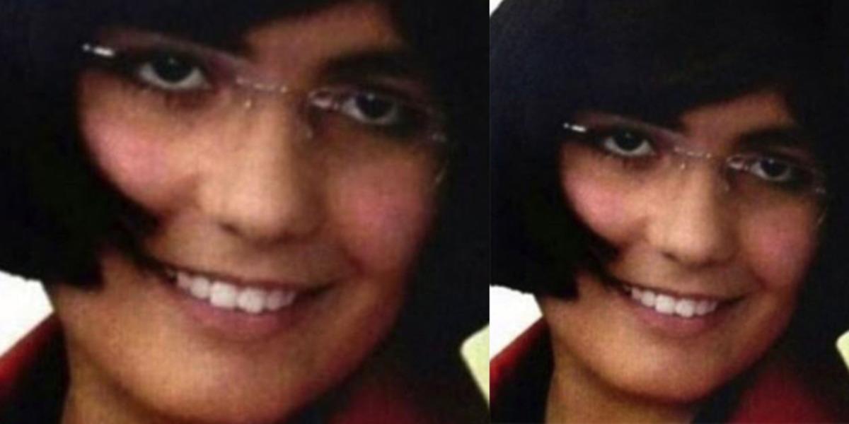 Estetikle bambaşka g&ouml;r&uuml;n&uuml;me kavuşan &uuml;nl&uuml;ler