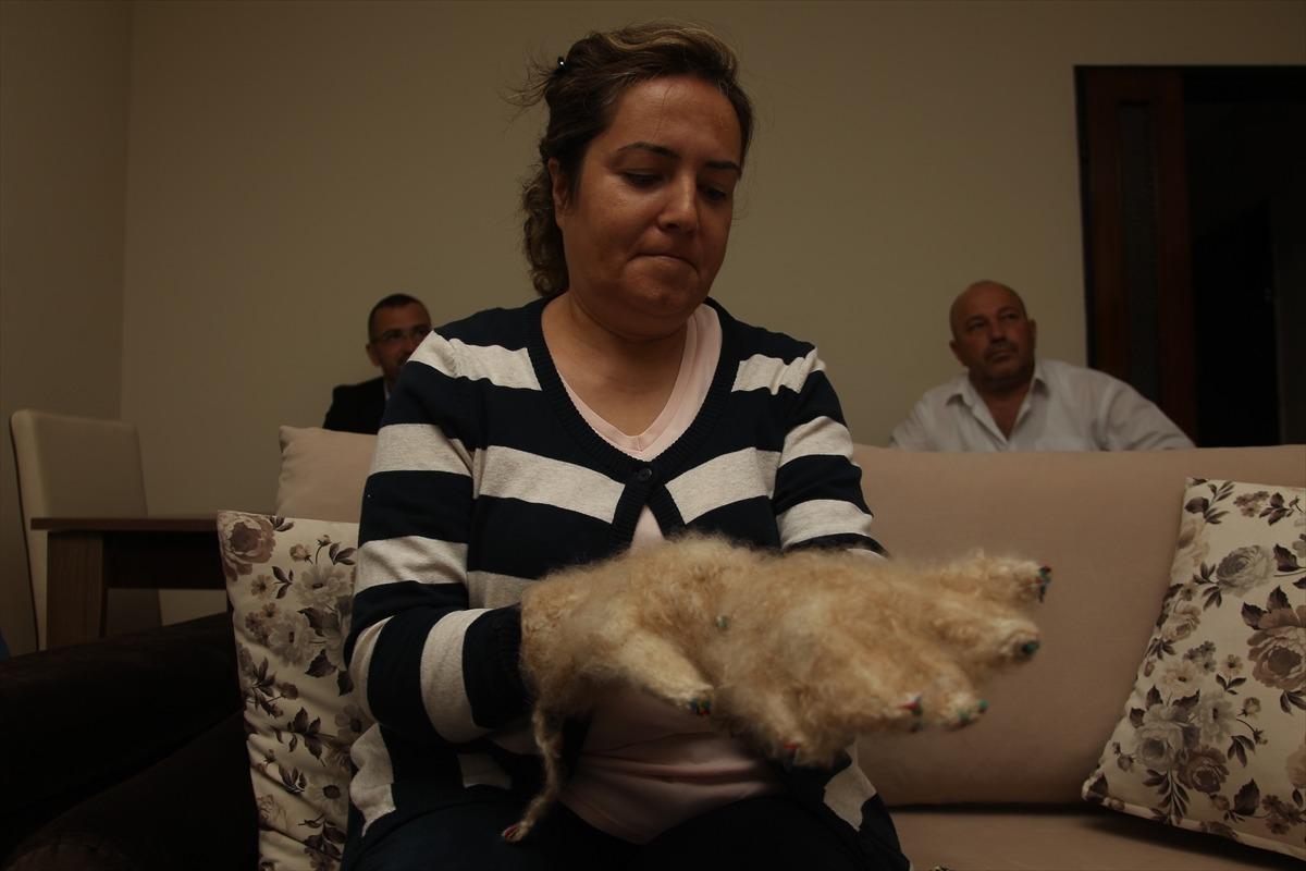 'Raynaud fenomeni' hastalığına yakalandı!