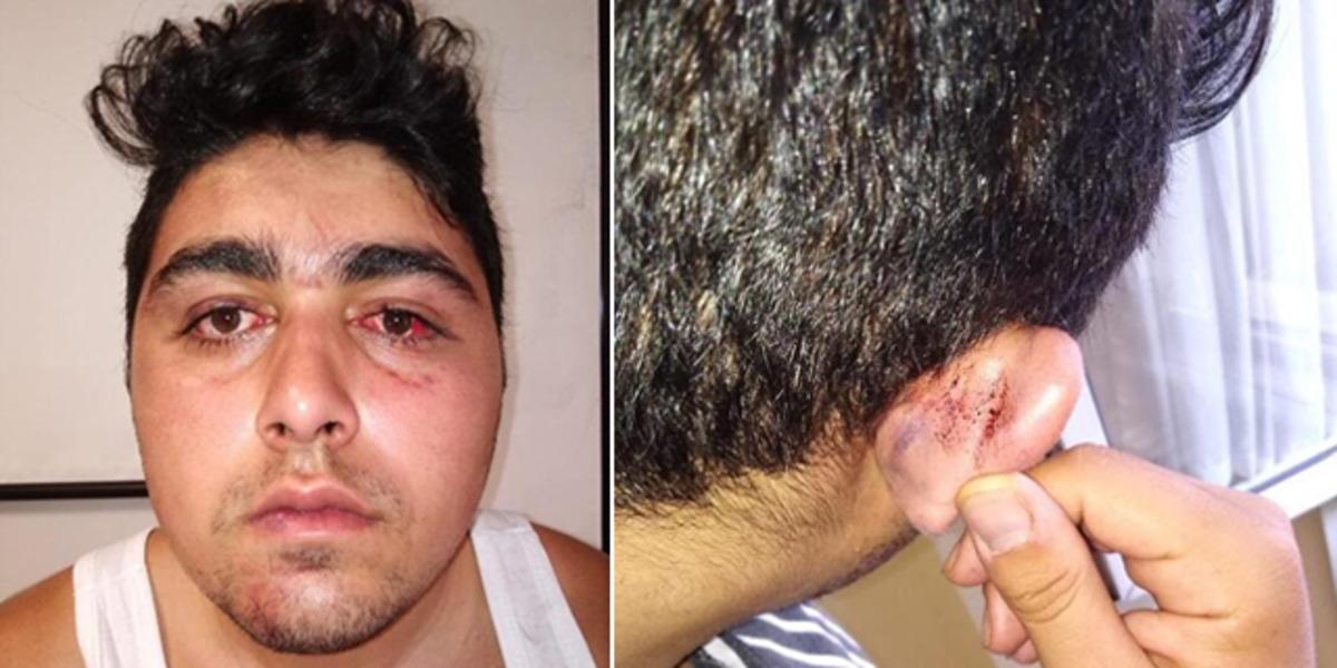 'Polisler darp etti' diyerek bu g&ouml;r&uuml;nt&uuml;lerle şikayet&ccedil;i oldu