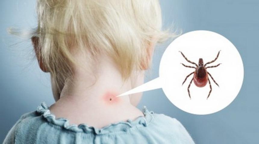 G&uuml;neşli G&uuml;nlerin Keyfini S&uuml;rerken Basit Ve Doğal Y&ouml;ntemlerle Kenelerden Kolayca Korunun!