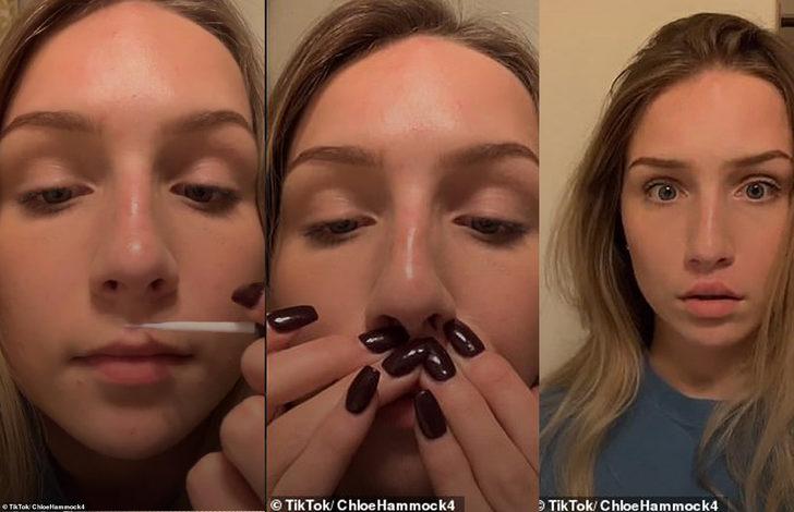 Uzmanlar uyarsa da dinlemiyorlar! Kadınlar bu kez dudaklarını dolgunlaştırmak için tutkal kullanmaya başladı G2