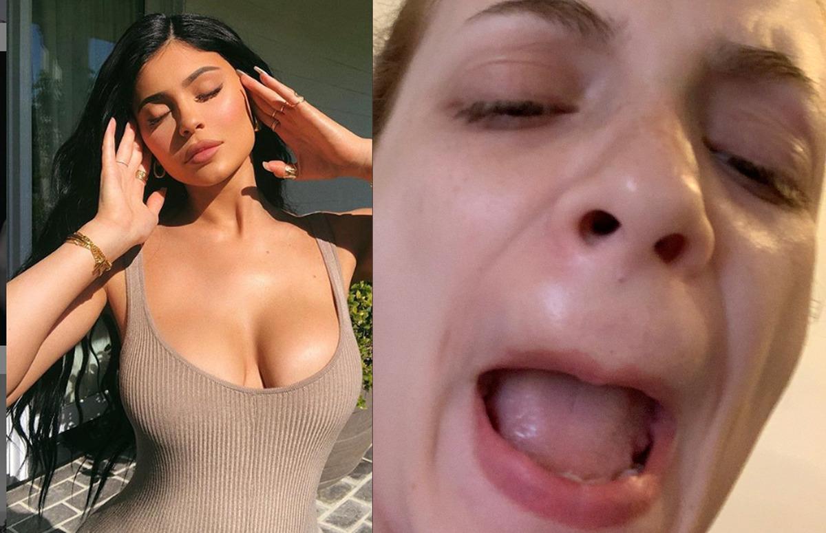 Uzmanlar uyarsa da dinlemiyorlar! Kadınlar bu kez dudaklarını dolgunlaştırmak i&ccedil;in tutkal kullanmaya başladı