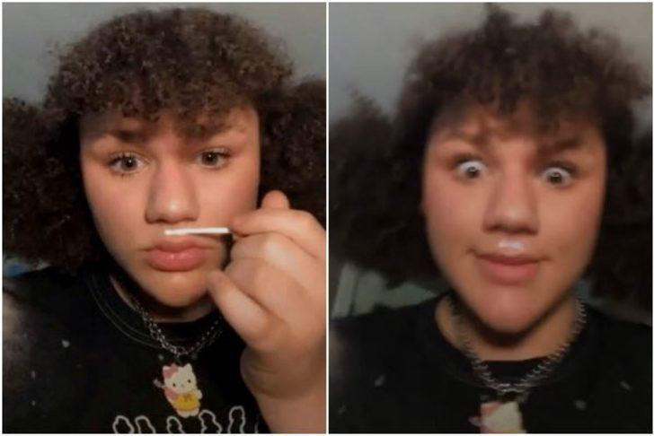 Uzmanlar uyarsa da dinlemiyorlar! Kadınlar bu kez dudaklarını dolgunlaştırmak için tutkal kullanmaya başladı G4