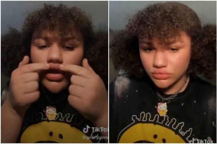 Uzmanlar uyarsa da dinlemiyorlar! Kadınlar bu kez dudaklarını dolgunlaştırmak için tutkal kullanmaya başladı G5