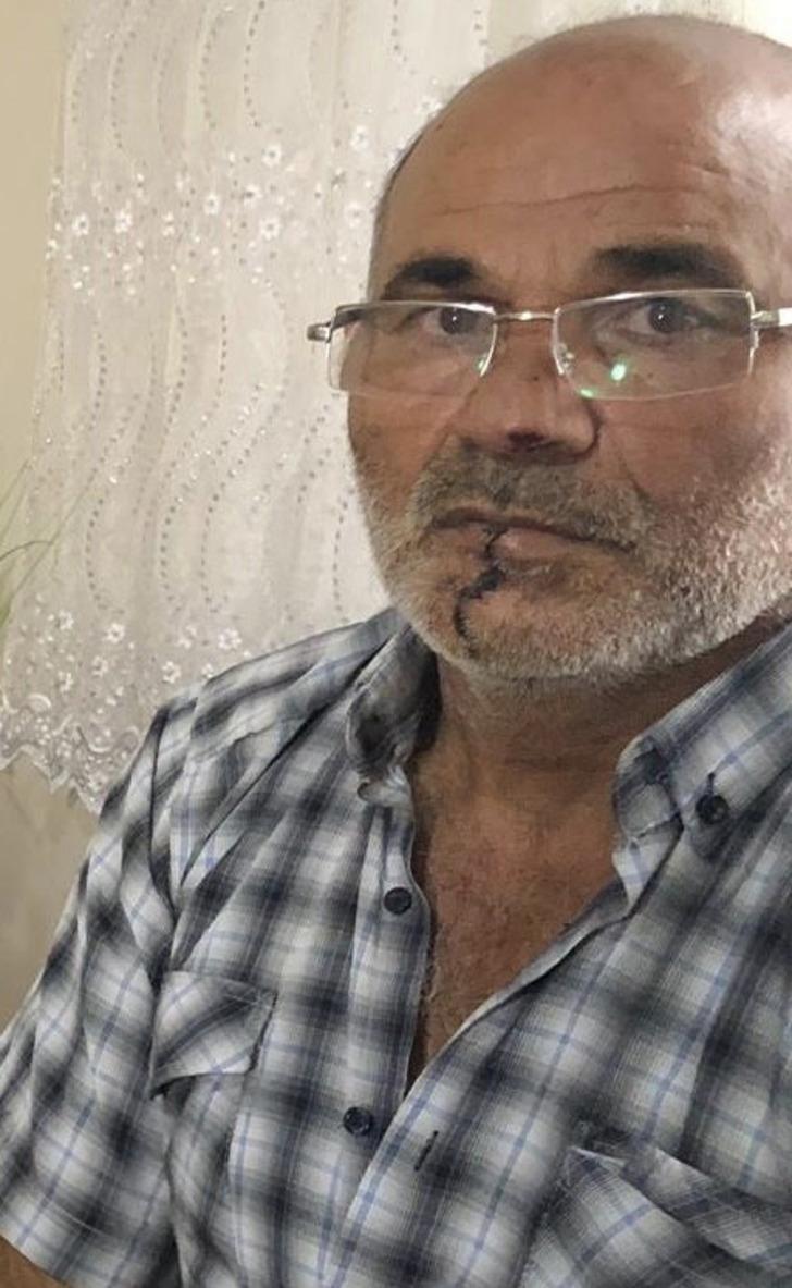 Kayınpederinin dudağını ısırmıştı! Yeni gelişme G2