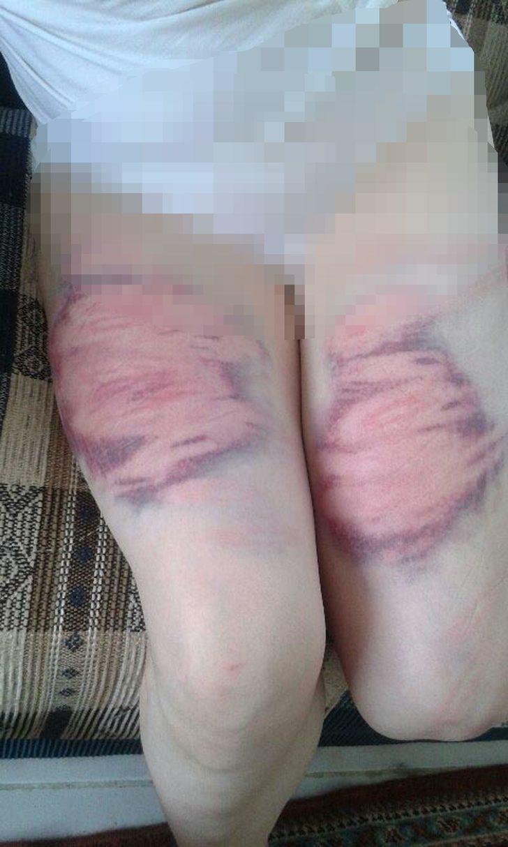 Eşini oklava ve kemerle döven sanığın cezası belli oldu G1