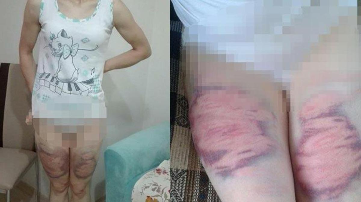 Eşini oklava ve kemerle d&ouml;ven sanığın cezası belli oldu