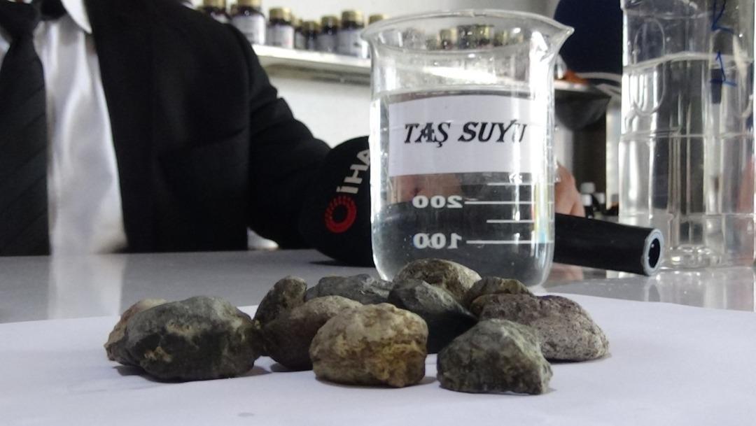 20 milyon dolarlık AR-GE kansere &ldquo;dur&rdquo; diyecek