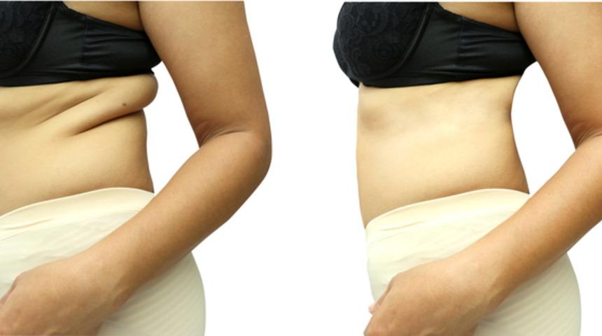  Yaza Az Kaldı: Hızlıca Kilo Vermenin Kanıtlanmış 3 Yolu