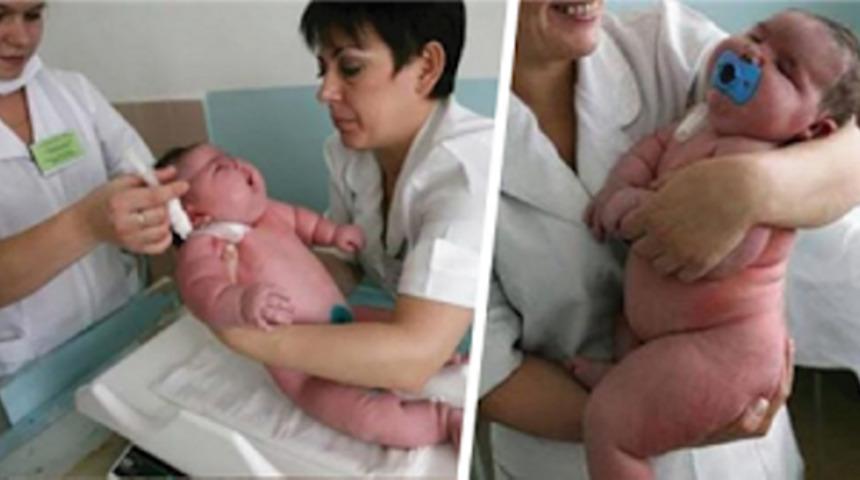 Gözlerimize İnanamadık: Dünyanın En Kilolu Bebeği Bakın Kaç Kilo Doğmuş!
