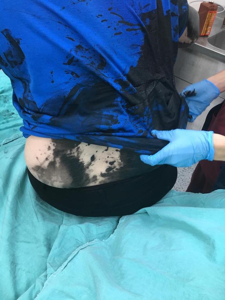 Genç kadını dövüp üzerine siyah renkli sıvı madde döktüler! G2