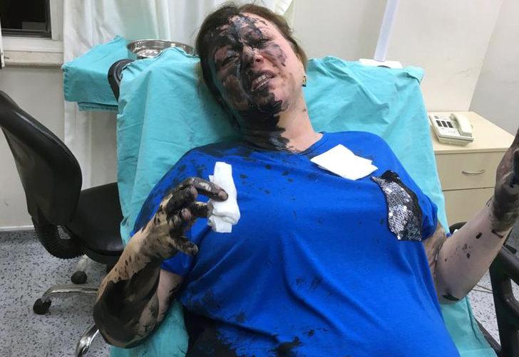 Genç kadını dövüp üzerine siyah renkli sıvı madde döktüler! G1