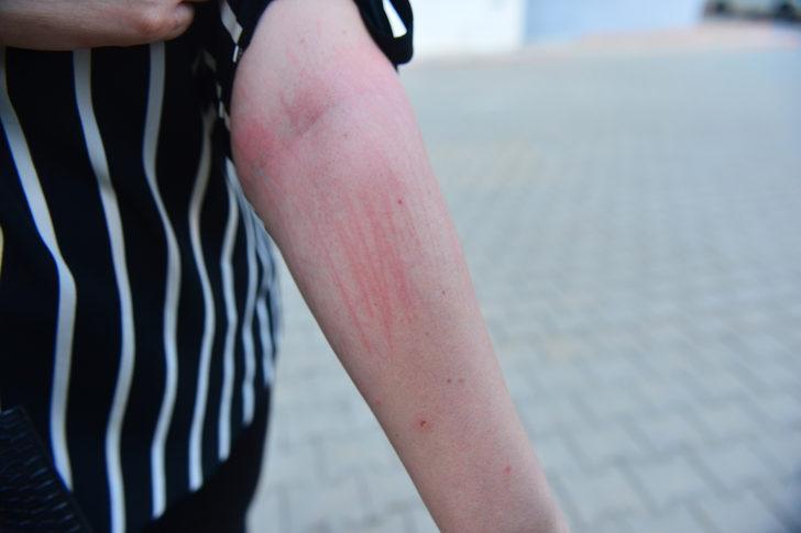 Genç kadını dövüp üzerine siyah renkli sıvı madde döktüler! G4