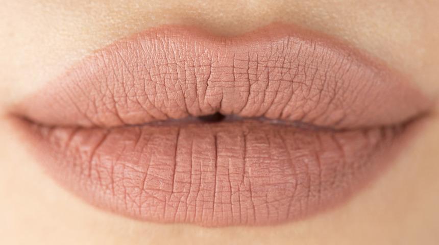 Liplift (Dudak Kaldırma) Nedir? 