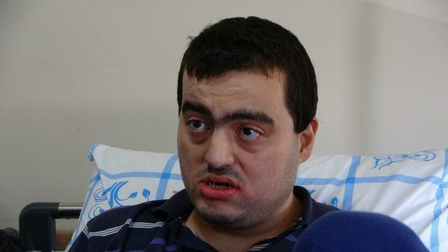 Tedavisi için Sağlık Bakanlığı’nın devreye girdiği engelli Tayfun ağrıyan dişinden kurtuldu
