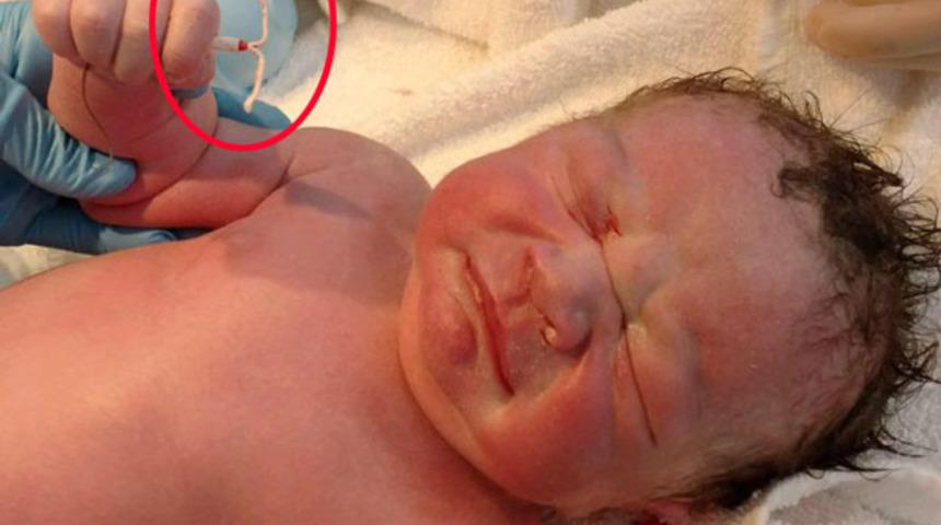 Tüm Doğum Kontrollerine Nanik Yaparak Spirale Rağmen Doğan Bebek!