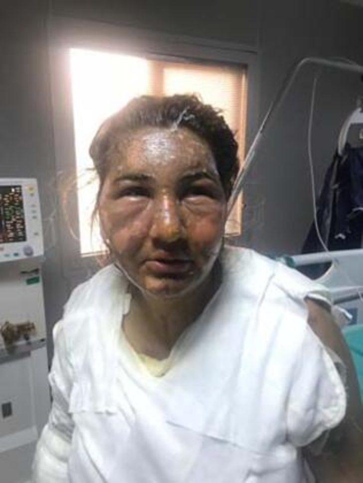 İstanbul'da vahşet! Önce bıçakladı sonra üzerine kızgın yağ döktü G5