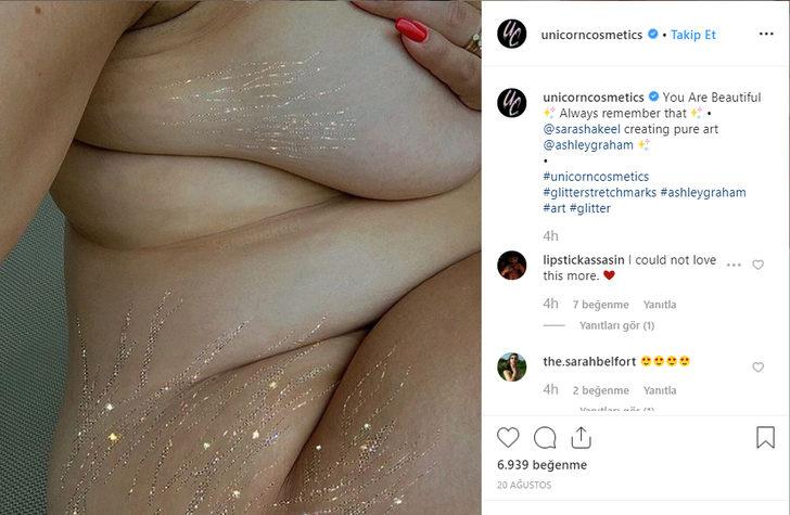 Güzellik standartlarına meydan okudular! Çatlak izlerini böyle ortaya çıkardılar  G1