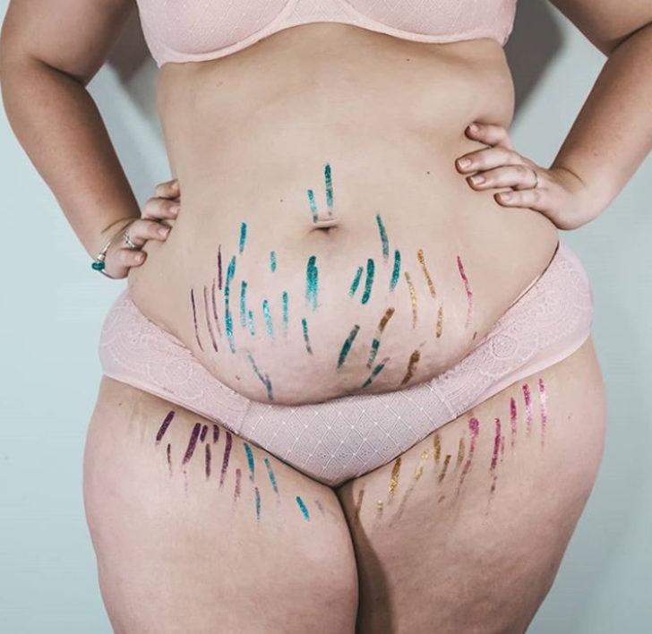 Güzellik standartlarına meydan okudular! Çatlak izlerini böyle ortaya çıkardılar  G3