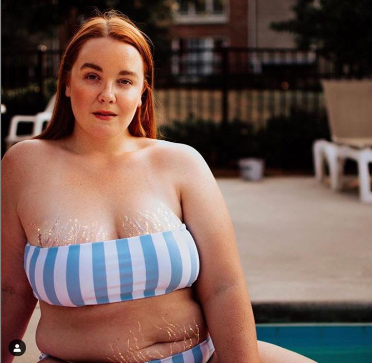 Güzellik standartlarına meydan okudular! Çatlak izlerini böyle ortaya çıkardılar  G5