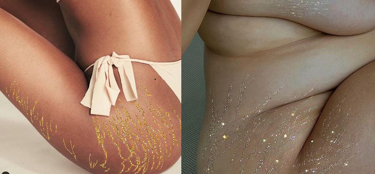 G&uuml;zellik standartlarına meydan okudular! &Ccedil;atlak izlerini b&ouml;yle ortaya &ccedil;ıkardılar 