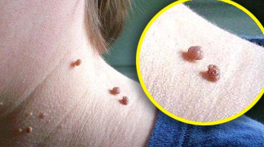 Cildinizi et benlerinden kurtaracak ev yapımı doğal ve basit tarifler 