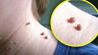 Cildinizi et benlerinden kurtaracak ev yapımı doğal ve basit tarifler 