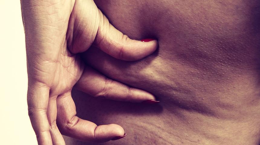 Bu yöntemle 2 ayda selülitlerden kurtulmak mümkün