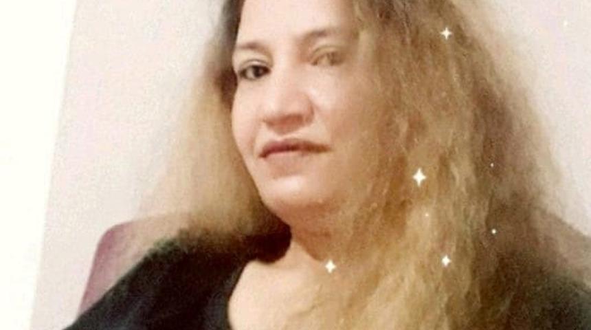 Eski eşi tarafından y&uuml;z&uuml;ne kezzap atılan kadın yaşam m&uuml;cadelesini kaybetti