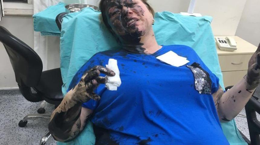 İş kadınını darp edip üzerine yanıcı madde dökmüştü! Tutuklandı