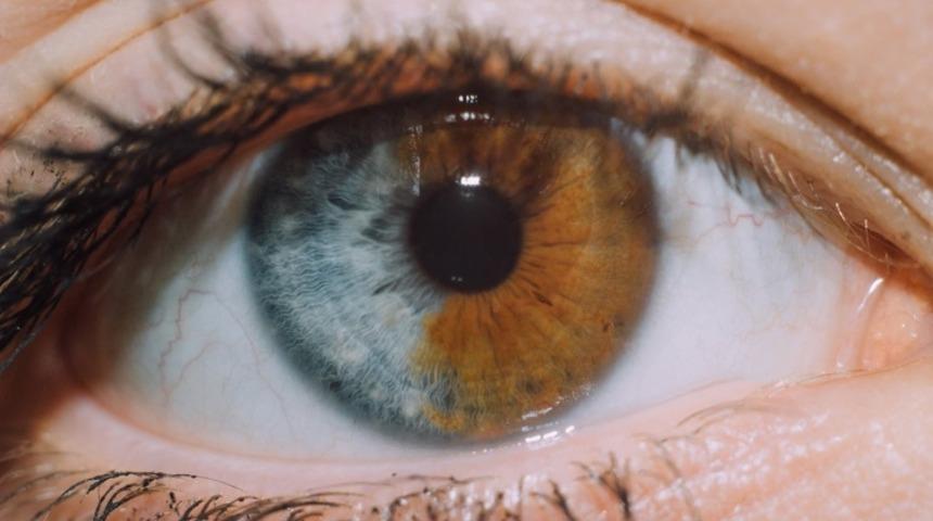 Hepsi gerçek! Kimisi perde ayaklı kimisinin göğüs ucu yok