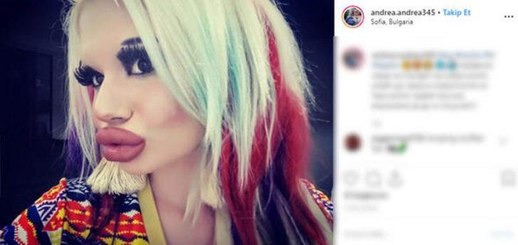 Dünyanın en büyük dudaklarına sahip olmak için yapmadığı kalmadı G4