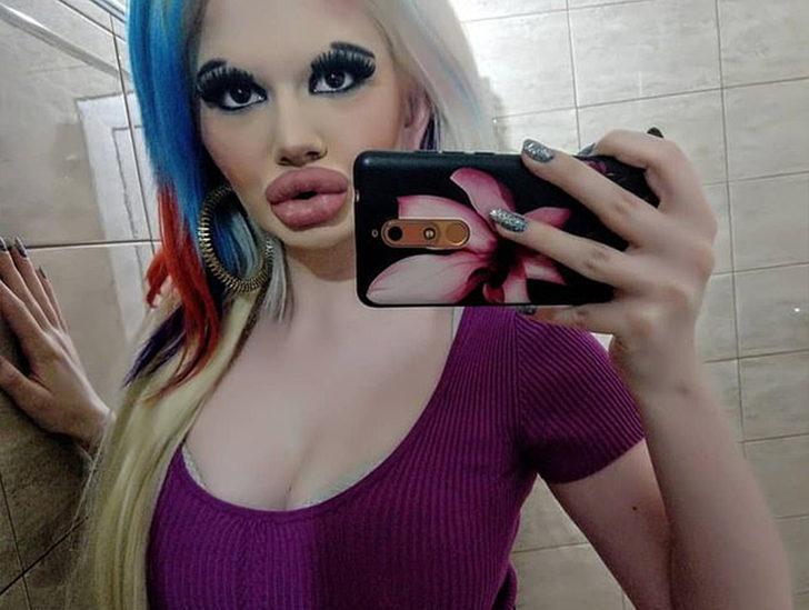 Dünyanın en büyük dudaklarına sahip olmak için yapmadığı kalmadı G5