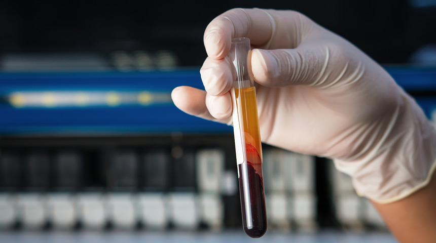 Brusella nedir? Brusella belirtileri nelerdir? Brusella tedavileri nelerdir? Brusella hastalığı olanlar ne yemeli?