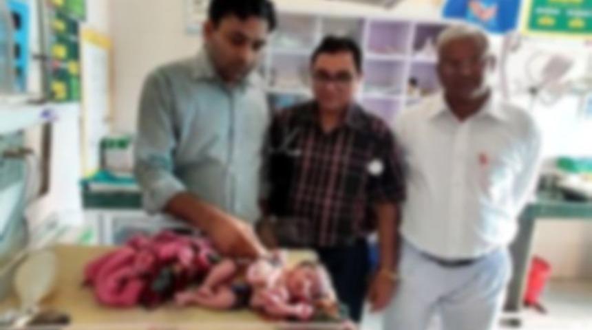 Dört bacaklı, üç kollu kız bebek dünyaya geldi