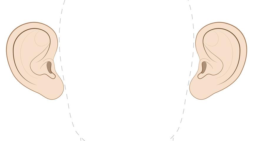 Kepçe kulak estetiği hakkında merak edilenler