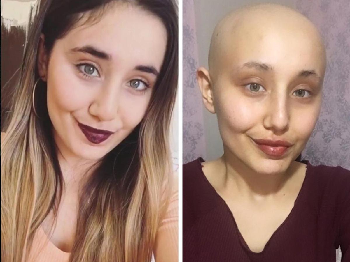 Ayy&uuml;ce'nin m&uuml;cadelesi s&uuml;r&uuml;yor! 4. kez ameliyata alındı